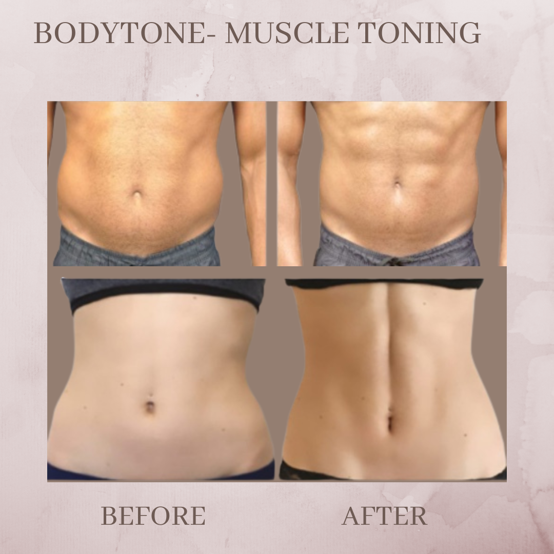 Body tone before and after