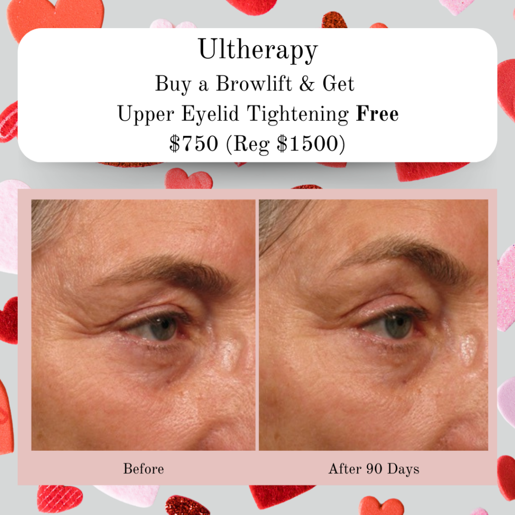 Ultherapy brow and eyelid tightening. How to lift and tighten eyebrows and eyelids without surgery. Jacksonville florida