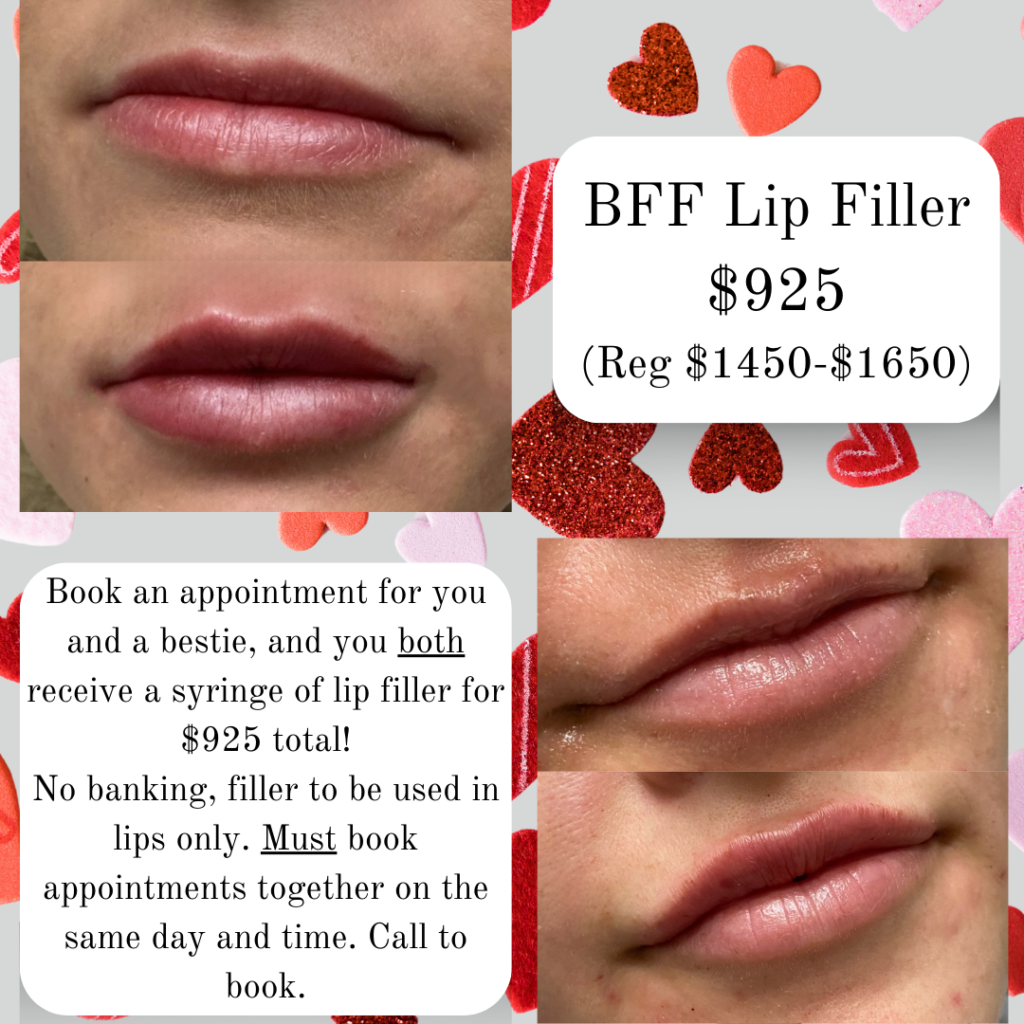 Lip filler juvederm, versa, buy one get one free. Things to do for valentines day jacksonville. What to get my friend on valentines day. What to get my wife on valentines day. What to get my girlfriend on valentines day.