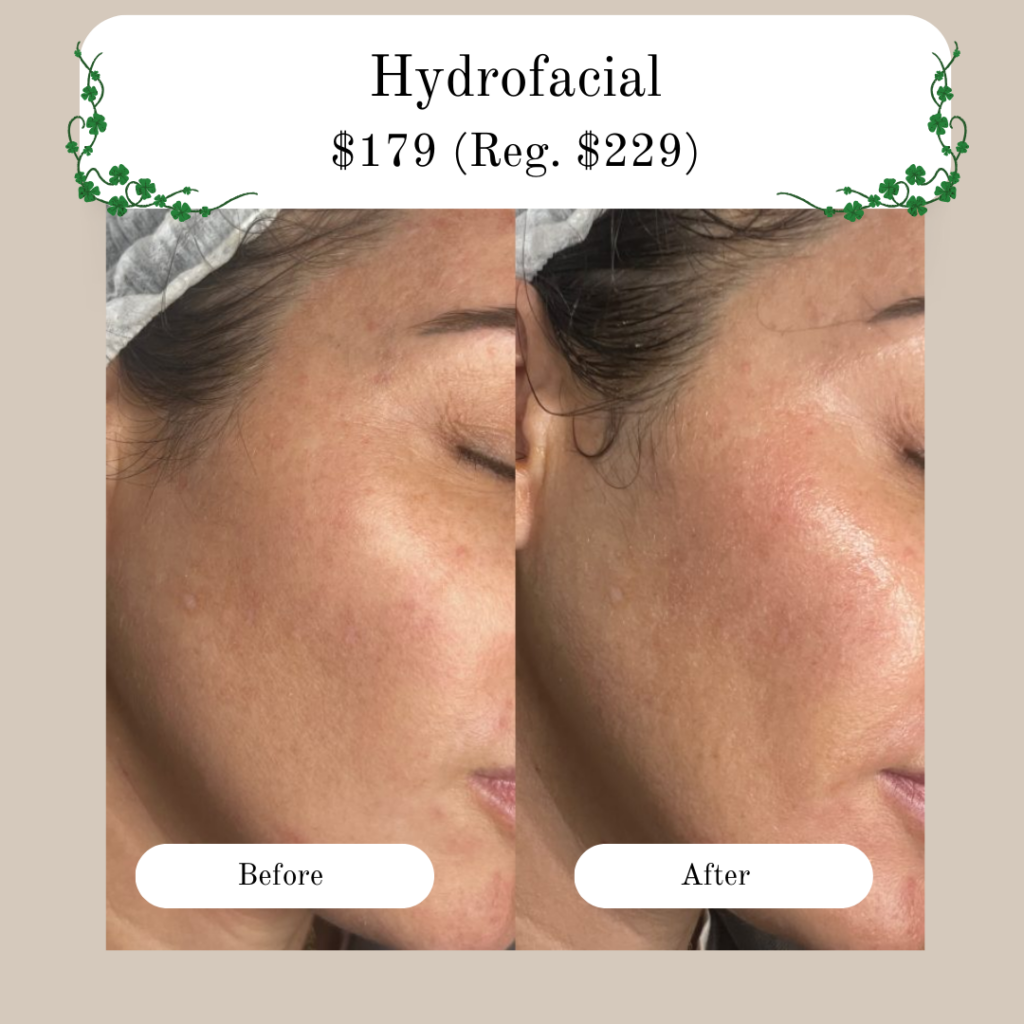 hydrofacial Glow