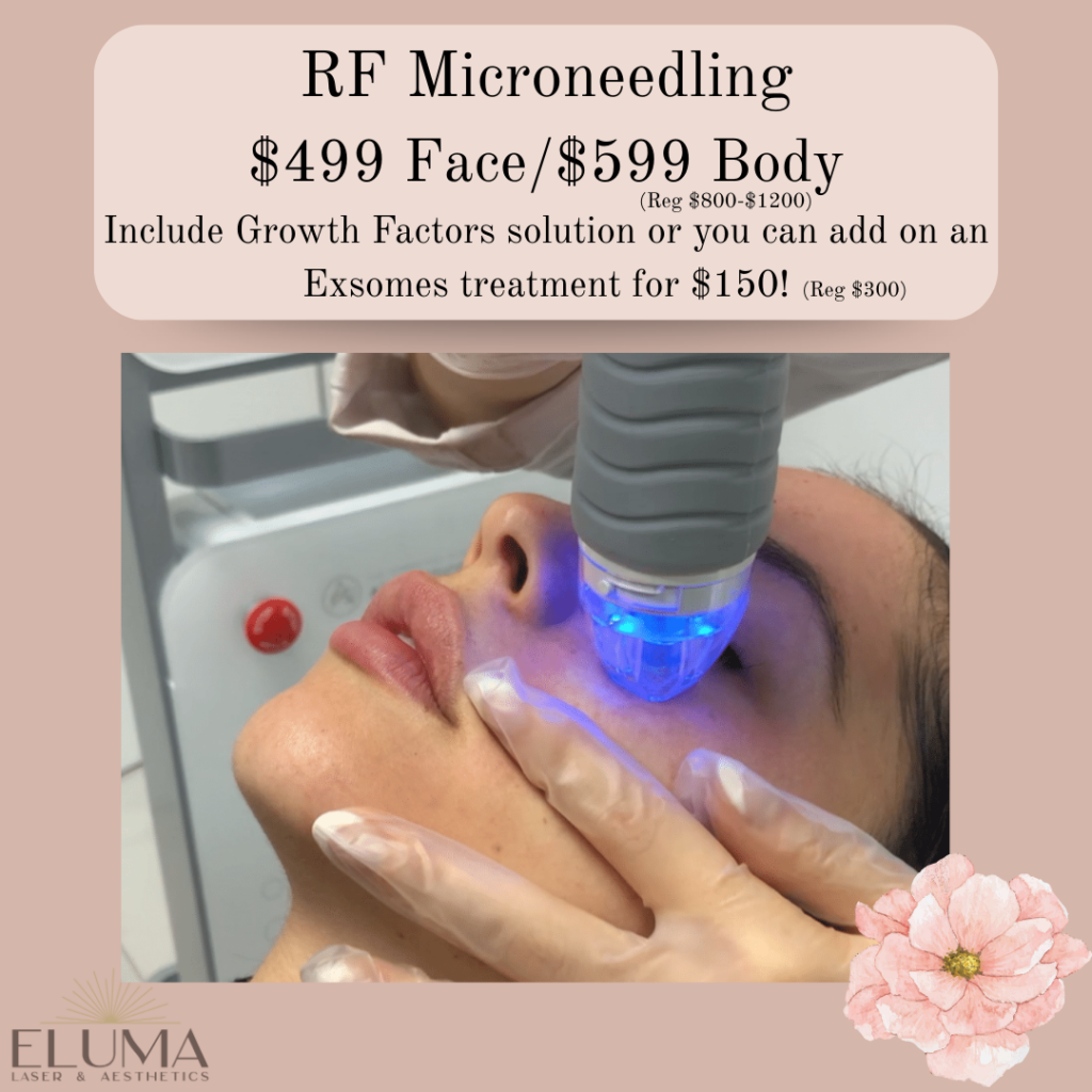 May Specials RF microneedling Eluma Laser and Aesthetics - Eluma - Laser & Aesthetics