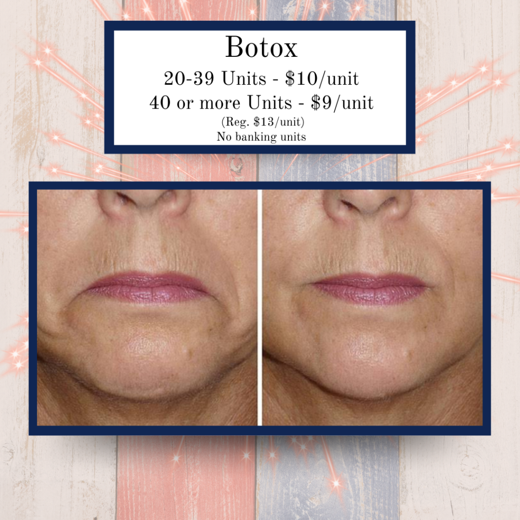 July '25 Specials 3 - Eluma - Laser & Aesthetics Eluma laser and Aesthetics Botox $9/unit