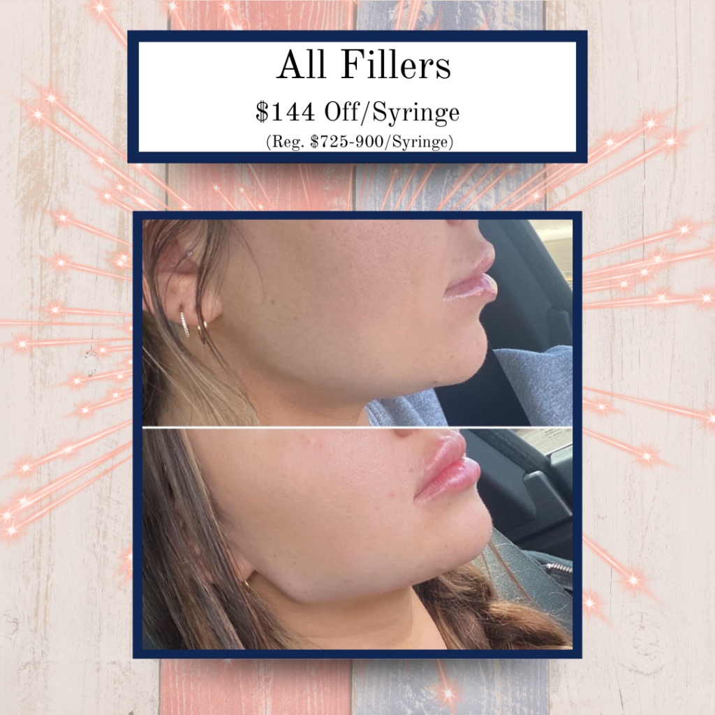 July '25 Specials 4 - Eluma - Laser & Aesthetics Eluma Laser and Aesthetics July Specials $144 off all Juvederm, Versa, restylane, RH3 fillers
