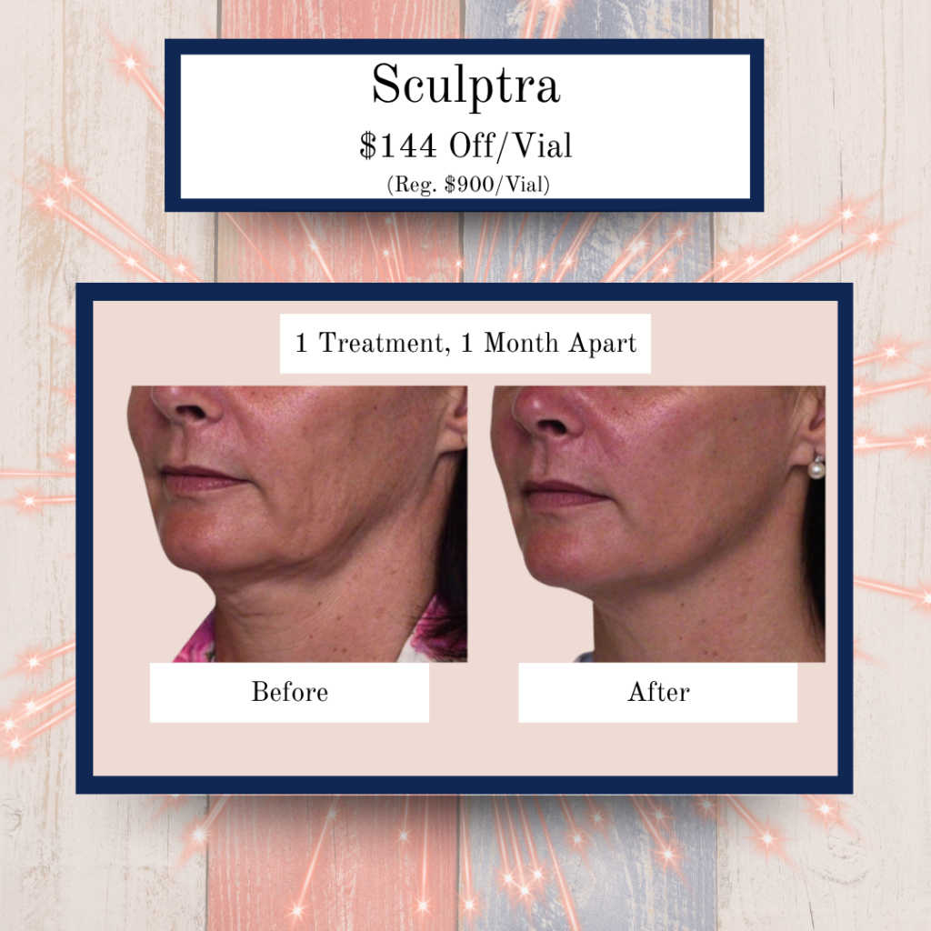 July '25 Specials 5 - Eluma - Laser & Aesthetics Eluma Laser and Aesthetics July Specials. Sculptra $144 off