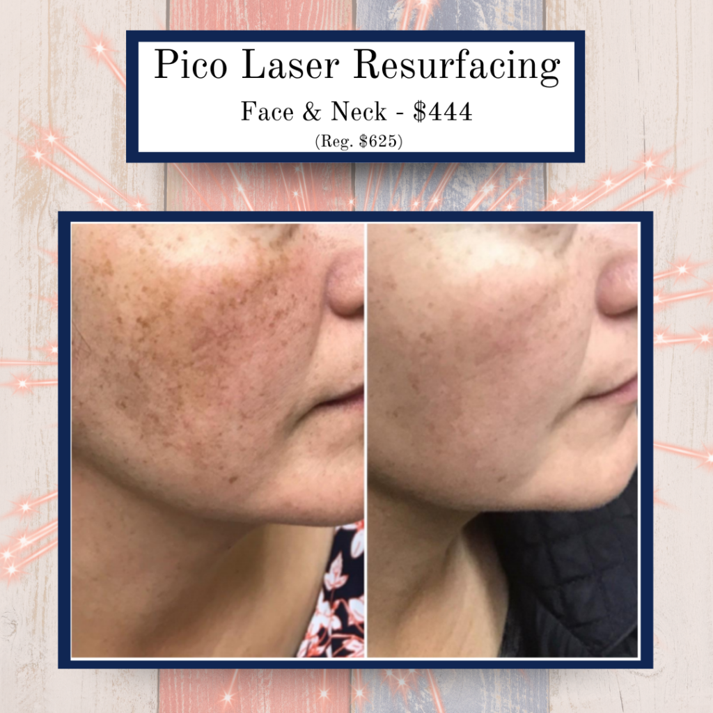 July '25 Specials 6 - Eluma - Laser & Aesthetics Eluma Laser and Aesthetics July Specials. Hyperpigmentation treatment, wrinkle laser treatment