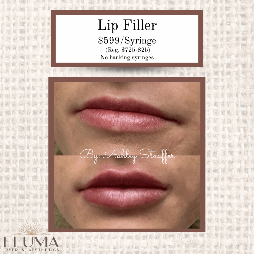 August Specials 4 - Eluma - Laser & Aesthetics