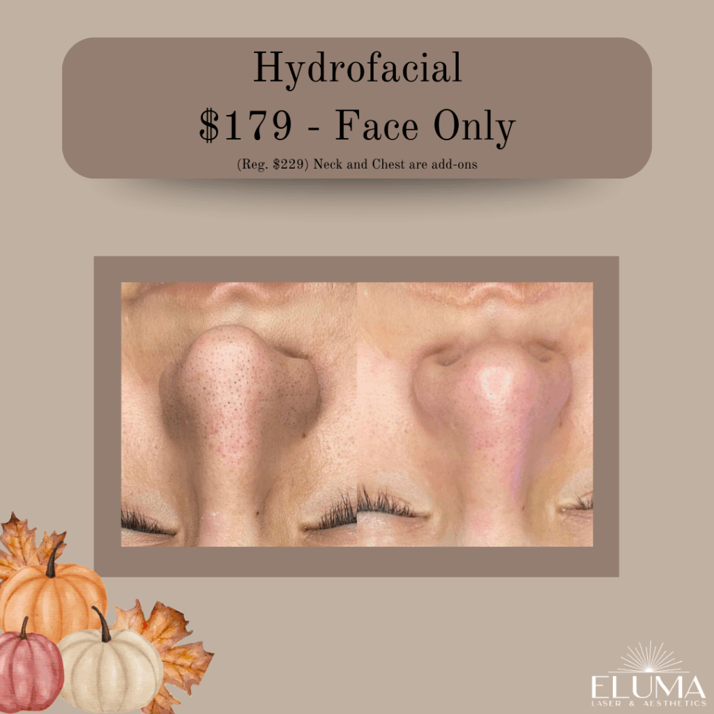 Eluma Laser and Aesthetics Hydrofacial specials - Eluma - Laser & Aesthetics