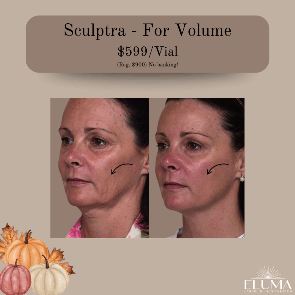 Eluma Laser and Aesthetics Sculptra Special - Eluma - Laser & Aesthetics