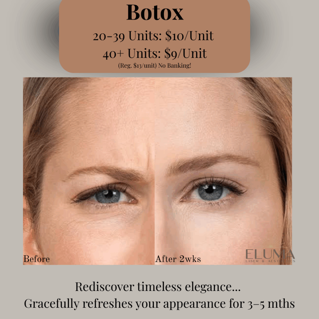 Eluma Laser and Aesthetics Botox Speical - Eluma - Laser & Aesthetics