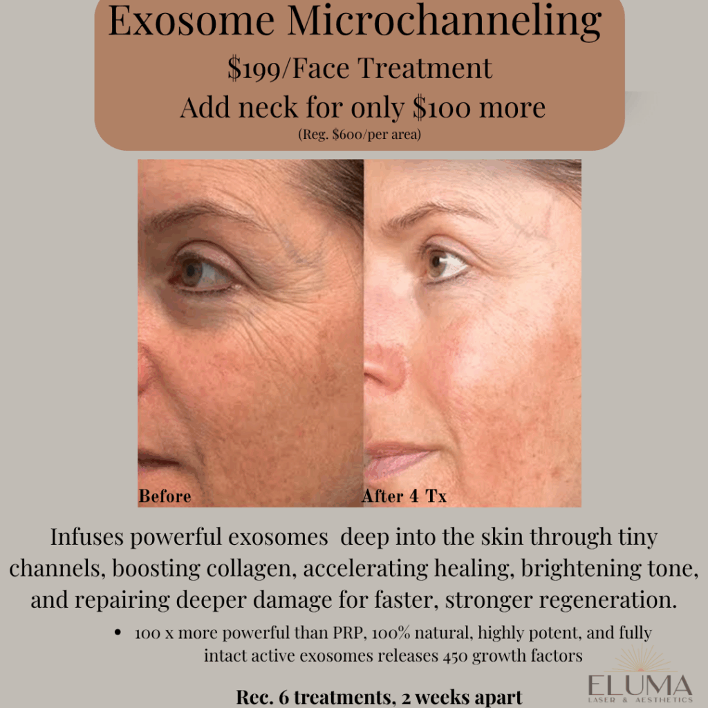 Eluma Laser and Aesthetics Exosome Micochanneling Facial treatment - Eluma - Laser & Aesthetics