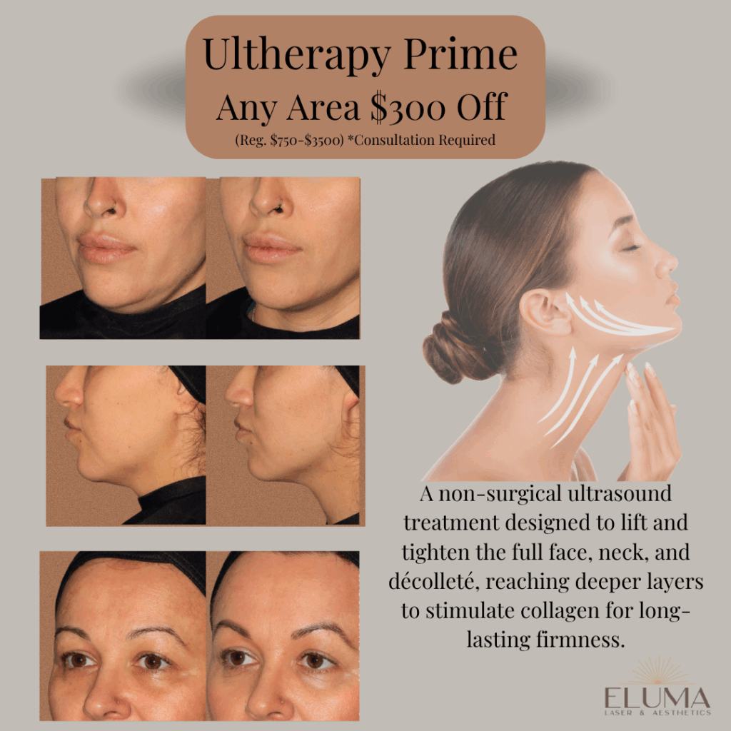Eluma Laser and Aesthetics Ultherapy Prime Specials - Eluma - Laser & Aesthetics