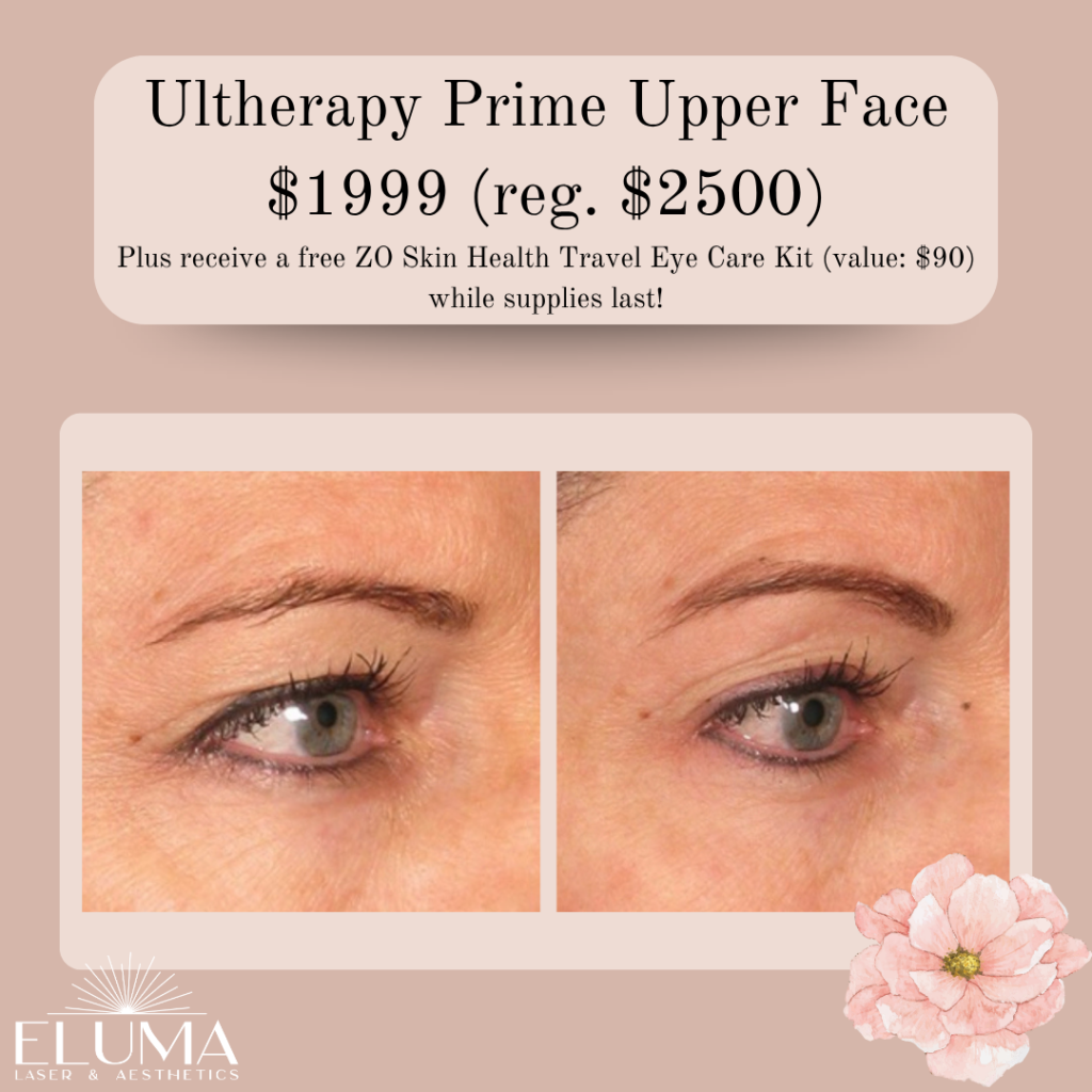 ultherapy prime - Eluma - Laser & Aesthetics Advertisement showing before-and-after close-ups of a woman's upper face (eye/brow area) after Ultherapy Prime treatment; price $1999 with free kit offer.