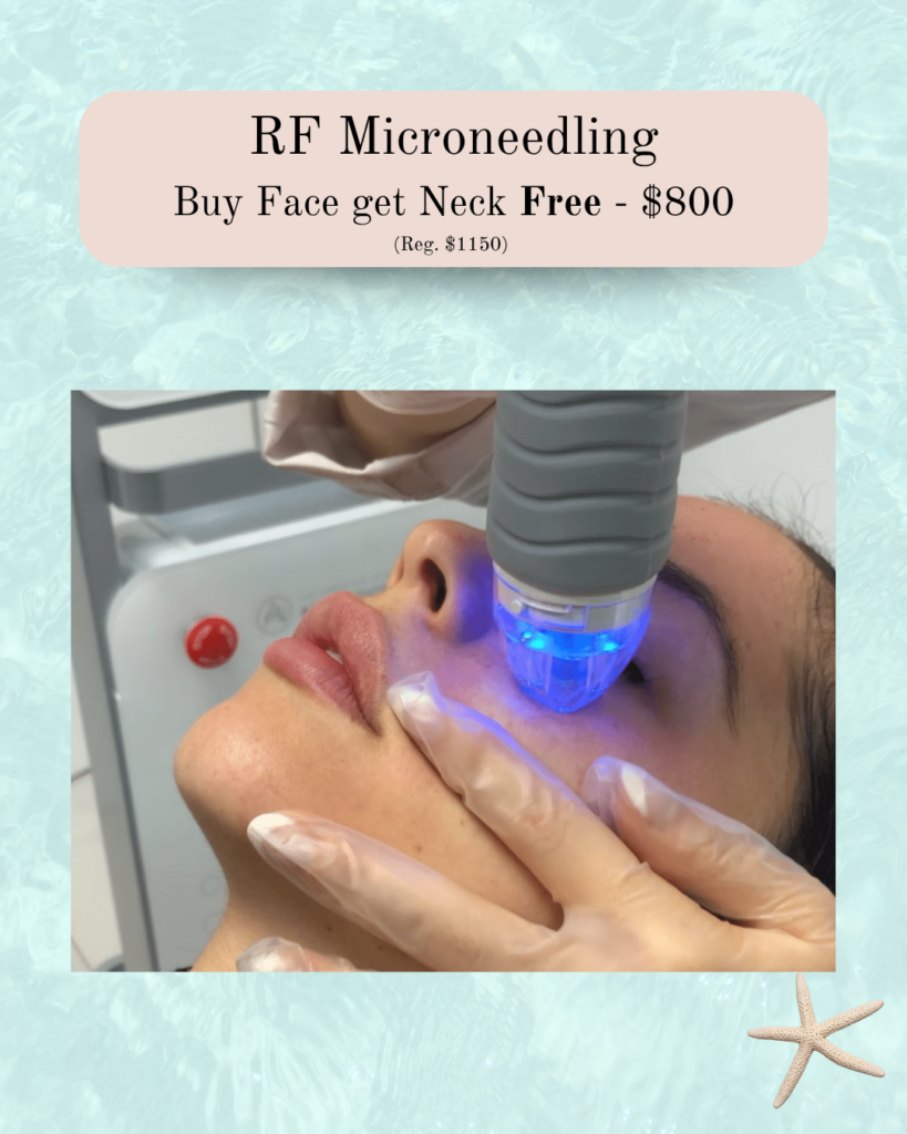 Woman receiving RF microneedling on the cheek; blue light device pressed near her skin, gloved clinician.