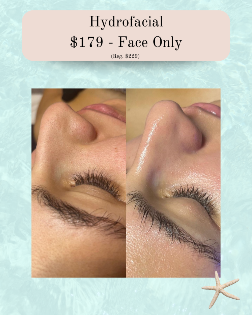 Promo image for Hydrofacial $179 (Face Only); side-by-side before-and-after close-ups of a nose and lashes showing improved skin.