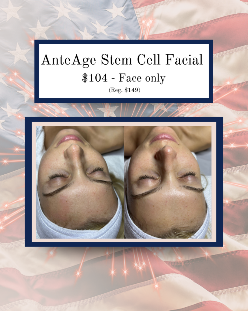 Promotional banner for AnteAge Stem Cell Facial showing before-and-after closeups of a woman's face, price $104 (face only).
