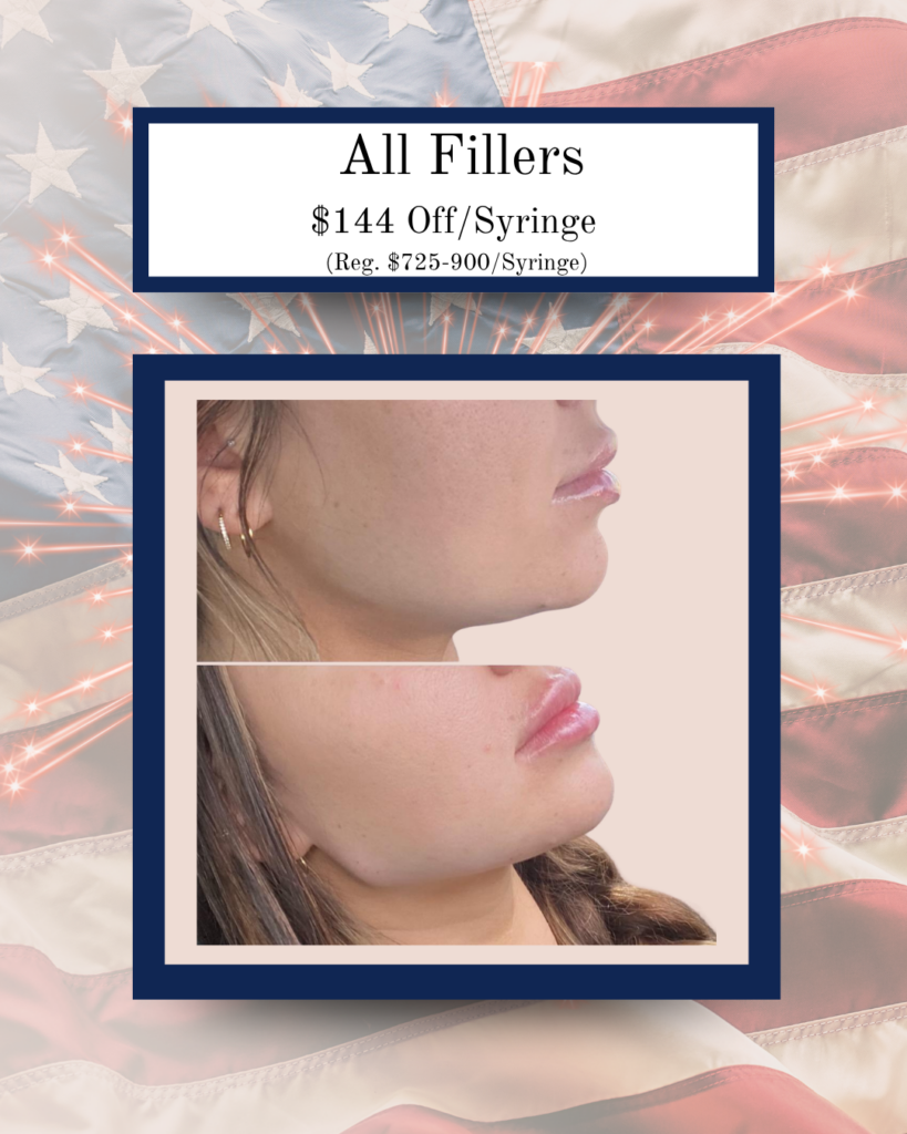 Promotion poster for facial fillers showing a before/after lip enhancement side profile with navy frames and patriotic background.