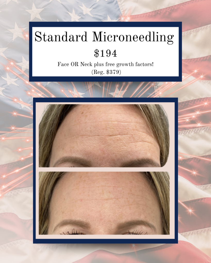 Promo card for Standard Microneedling: $194, Face or Neck plus free growth factors; shows before/after forehead close-ups on a flag background.