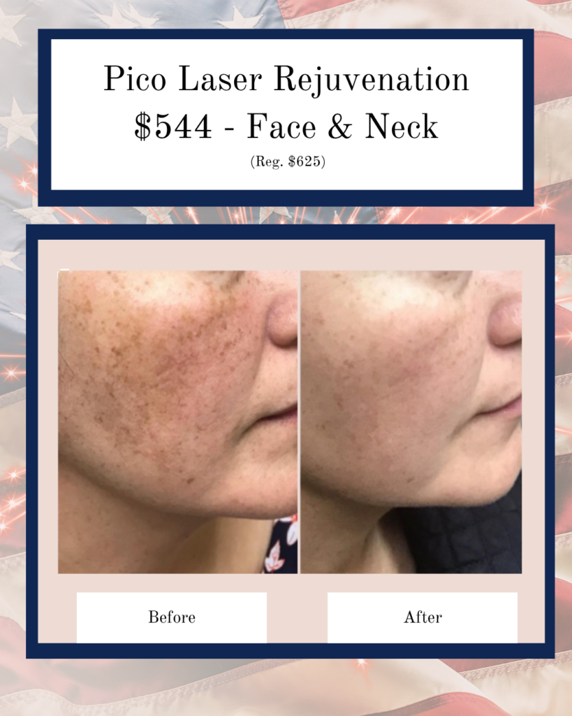 Promo for Pico Laser Rejuvenation—Face & Neck, $544 (Reg. $625). Side-by-side before and after photo of a woman's cheek showing improved skin texture.