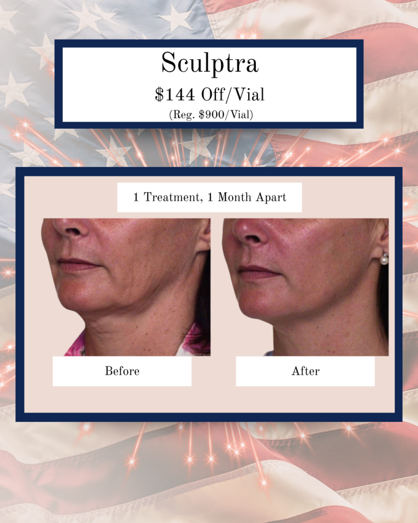 Advertisement for Sculptra showing a before-and-after facial rejuvenation comparison (1 month apart) with a mid-face/neck treatment, promo text "$144 Off/Vial" and header.
