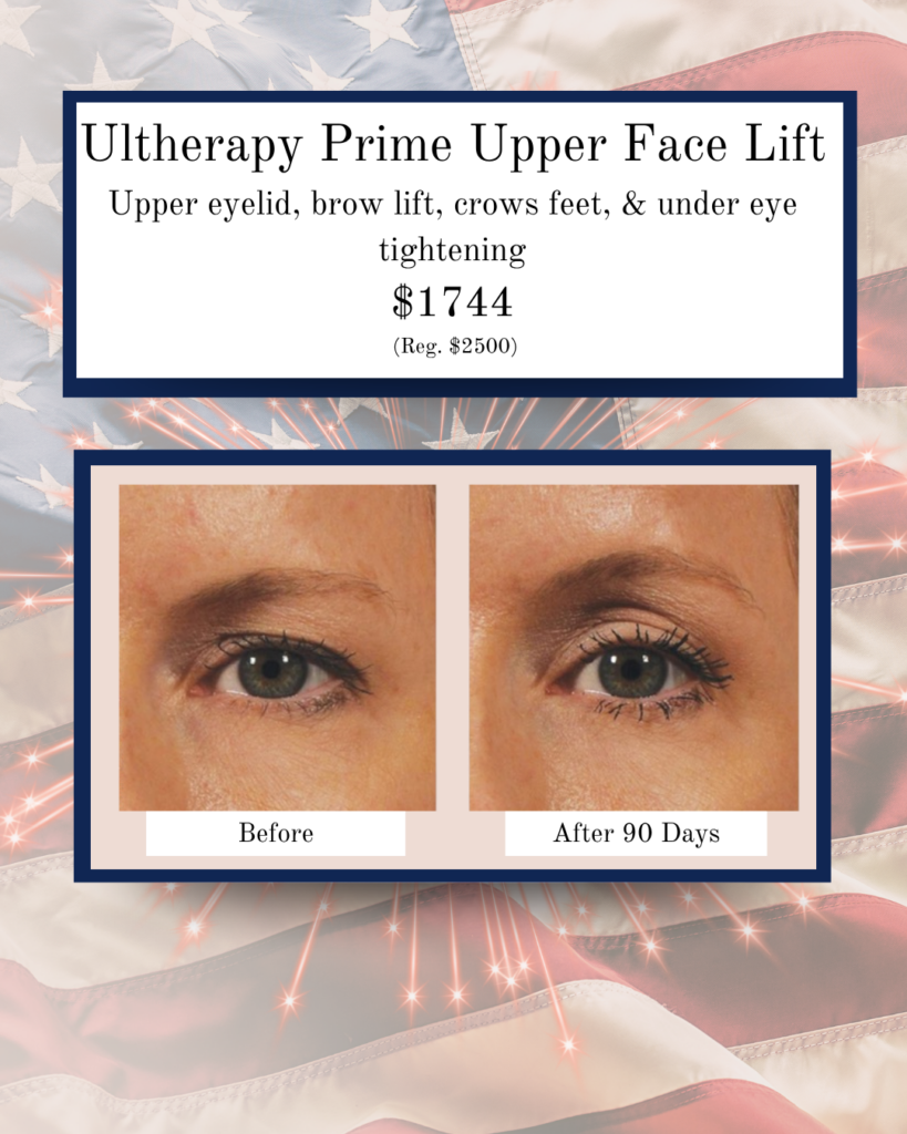 Advertisement for Ultherapy Prime Upper Face Lift showing before vs after 90 days, highlighting eyelid/brow lift and eye tightening; price $1744 (Reg. $2500).