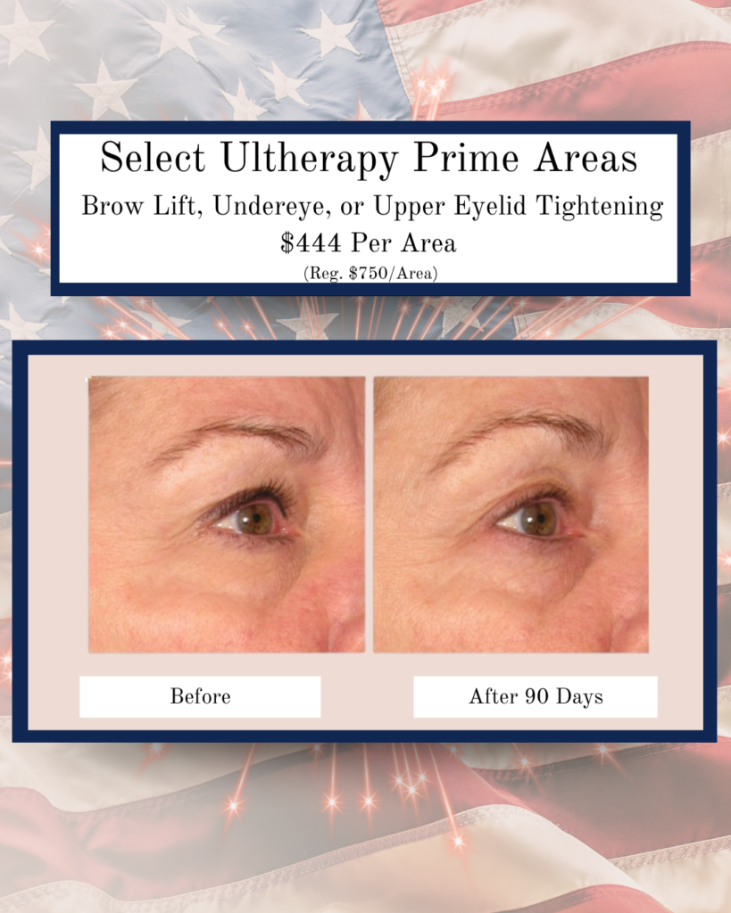 Promotional image for Ultherapy Prime Areas showing brow lift results: before (left) and after 90 days (right).
