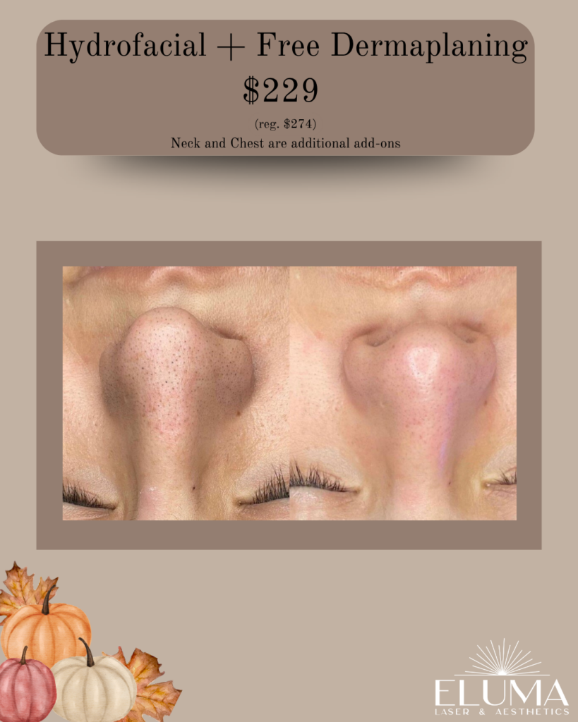 hydrofacial 10 - Eluma - Laser & Aesthetics Advertisement for Hydrofacial + Free Dermaplaning at $229; close-up of a woman's nose before/after dermaplaning, showing reduced pore visibility, ELUMA Laser & Aesthetics branding.
