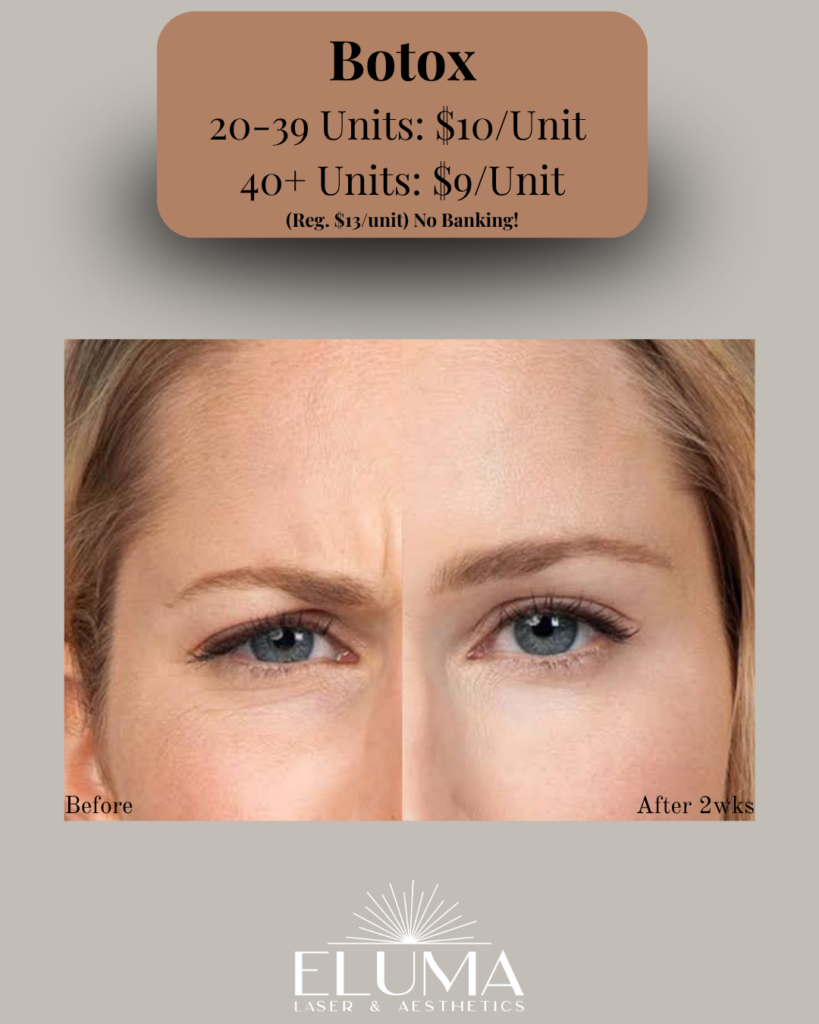Pricing card reads: 'Botox' with '20-39 Units: $10/Unit' and '40+ Units: $9/Unit' and '(Reg. $13/unit) No Banking!', displayed above a before/after close-up of a woman's eyes; ELUMA logo below.